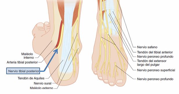 Tendinitis Tibial Posterior - Praxia Body Repair