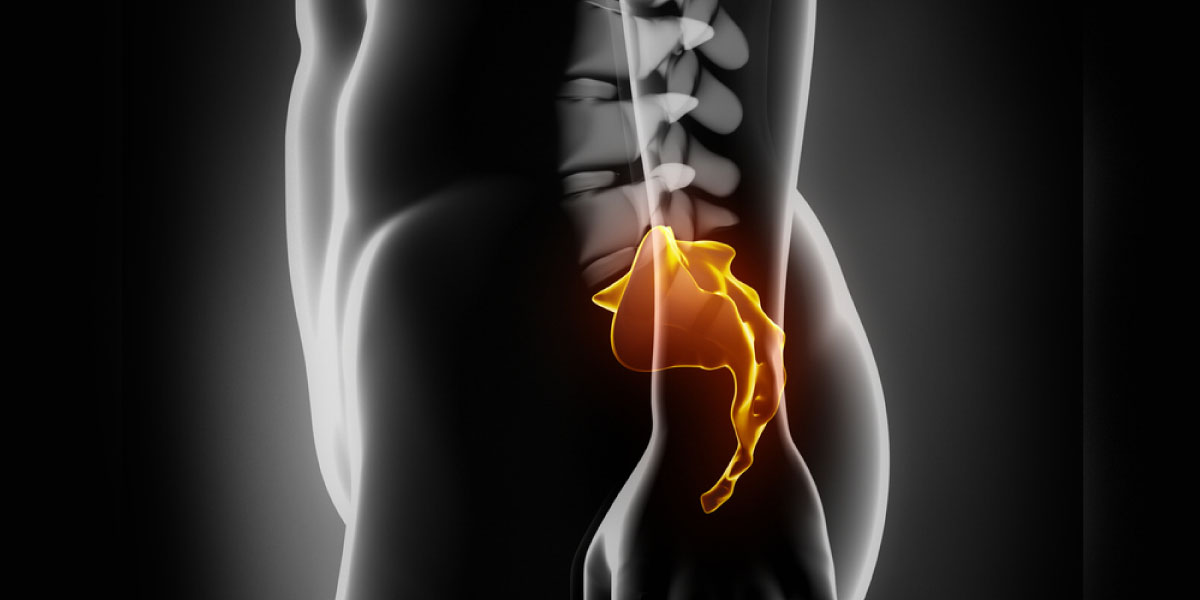 Coccigodinia o dolor en el coxis - Praxia Body Repair